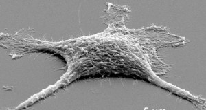 des-chercheurs-ont-elabore-une-cellule-zombie-plus-efficace-morte-que-vivante-une