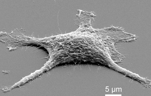 des-chercheurs-ont-elabore-une-cellule-zombie-plus-efficace-morte-que-vivante-une
