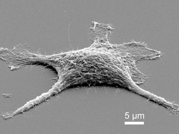 des-chercheurs-ont-elabore-une-cellule-zombie-plus-efficace-morte-que-vivante-une