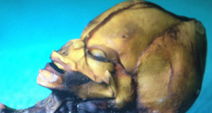 ladn-data-extraterrestre-humanoide-decouvert-au-chili-vient-detre-analyse-une