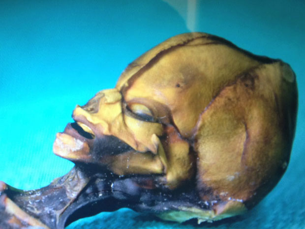 ladn-data-extraterrestre-humanoide-decouvert-au-chili-vient-detre-analyse-une