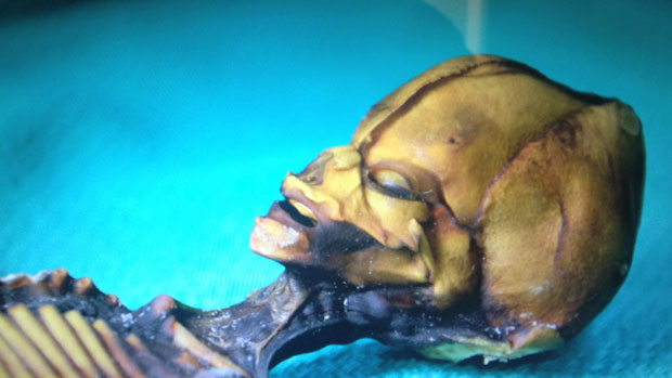 ladn-data-extraterrestre-humanoide-decouvert-au-chili-vient-detre-analyse1