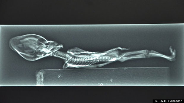 ladn-data-extraterrestre-humanoide-decouvert-au-chili-vient-detre-analyse2