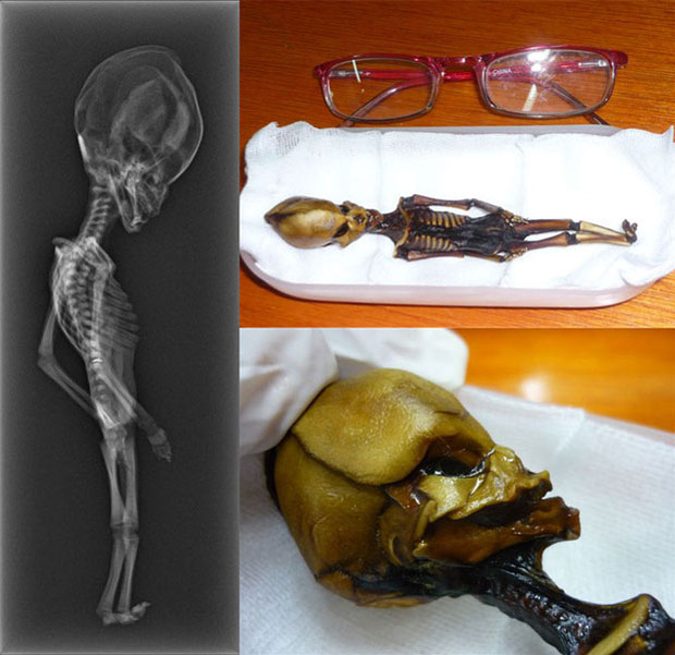 ladn-data-extraterrestre-humanoide-decouvert-au-chili-vient-detre-analyse4