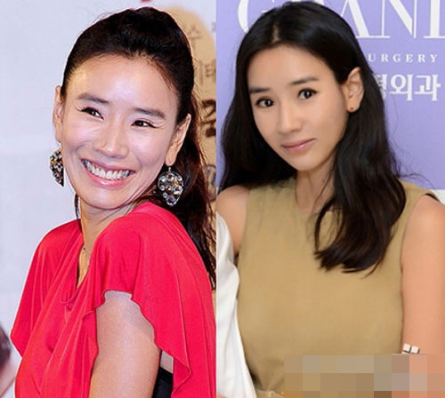 avantapres-31-photos-completement-folles-de-chirurgie-esthetique-en-coree-du-sud24