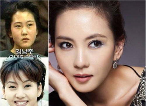 avantapres-31-photos-completement-folles-de-chirurgie-esthetique-en-coree-du-sud26