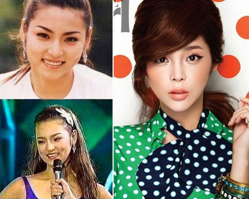 avantapres-31-photos-completement-folles-de-chirurgie-esthetique-en-coree-du-sud27