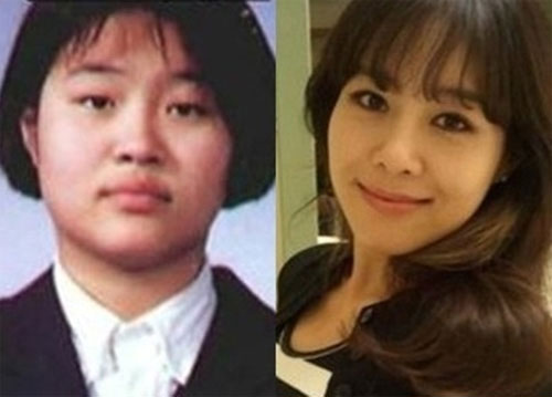 avantapres-31-photos-completement-folles-de-chirurgie-esthetique-en-coree-du-sud28