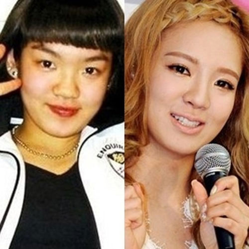 avantapres-31-photos-completement-folles-de-chirurgie-esthetique-en-coree-du-sud29