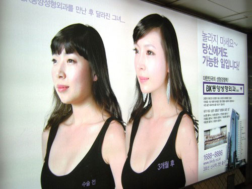 avantapres-31-photos-completement-folles-de-chirurgie-esthetique-en-coree-du-sud31