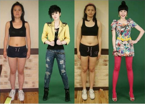 avantapres-31-photos-completement-folles-de-chirurgie-esthetique-en-coree-du-sud7