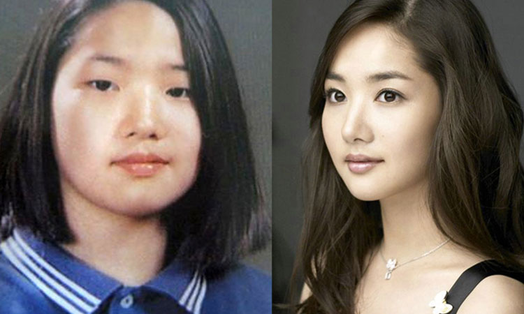 avantapres-31-photos-completement-folles-de-chirurgie-esthetique-en-coree-du-sudUne