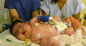 voici-jasleen-l-un-des-plus-gros-bebes-du-monde-ne-sans-cesarienne