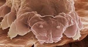 demodex-folliculorum-lacarien-rampant-qui-infeste-votre-visage-et-dont-les-excrements-provoqueraient-la-couperose-une