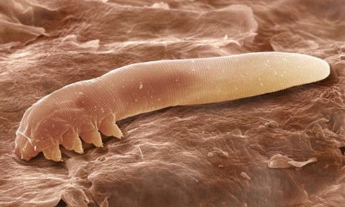 demodex-folliculorum-lacarien-rampant-qui-infeste-votre-visage-et-dont-les-excrements-provoqueraient-la-couperose1