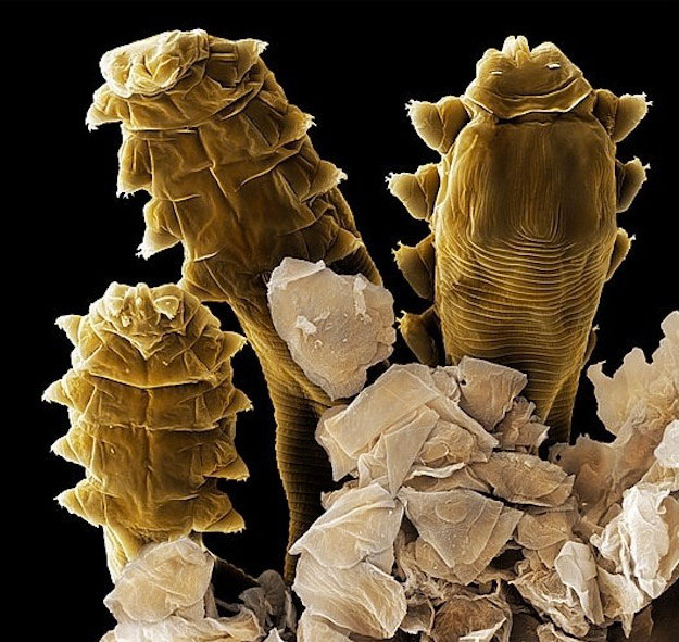 voici-le-demodex-folliculorum-un-minuscule-acarien-responsable-d-une-vilaine-maladie-de-la-peau1