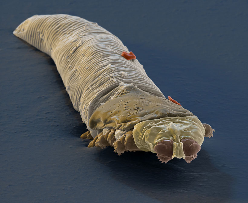 voici-le-demodex-folliculorum-un-minuscule-acarien-responsable-d-une-vilaine-maladie-de-la-peau5