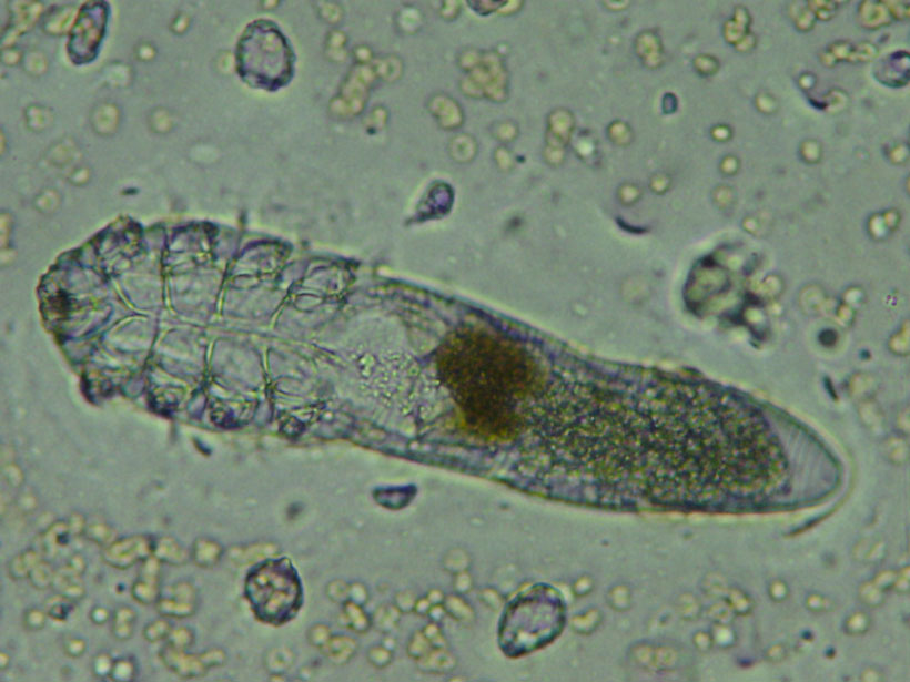 voici-le-demodex-folliculorum-un-minuscule-acarien-responsable-d-une-vilaine-maladie-de-la-peau6
