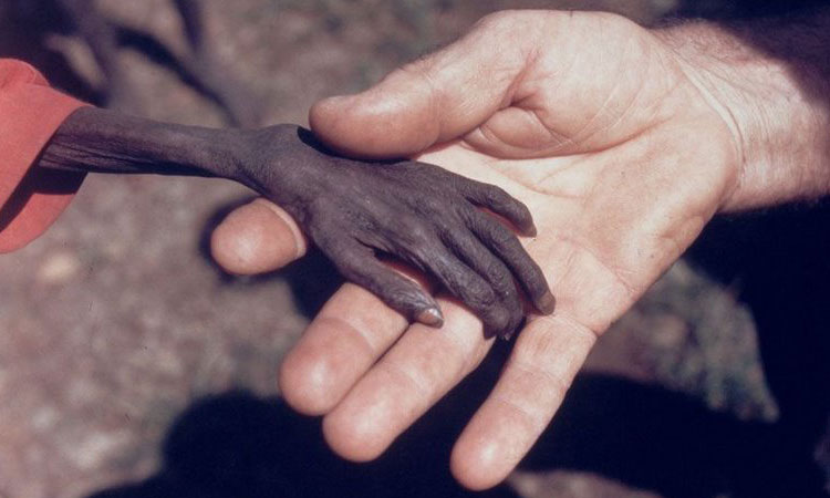 35-photographies-lourdes-de-sens-qui-vous-ouvriront-les-yeux-sur-le-mondeUne