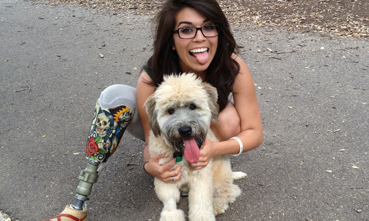 abandonnons-les-prejuges-40-femmes-handicapees-nous-prouvent-quelles-sont-aussi-resplendissantes-que-les-autres-Une