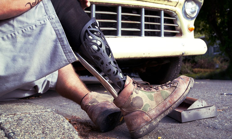 les-personnes-handicapees-ont-aussi-le-droit-detre-a-la-mode-la-preuve-avec-ces-magnifiques-protheses-une