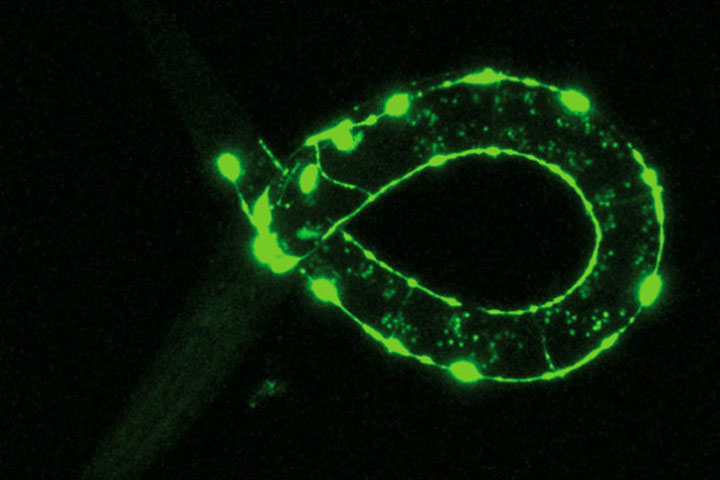 processus-doubli-du-cerveau2