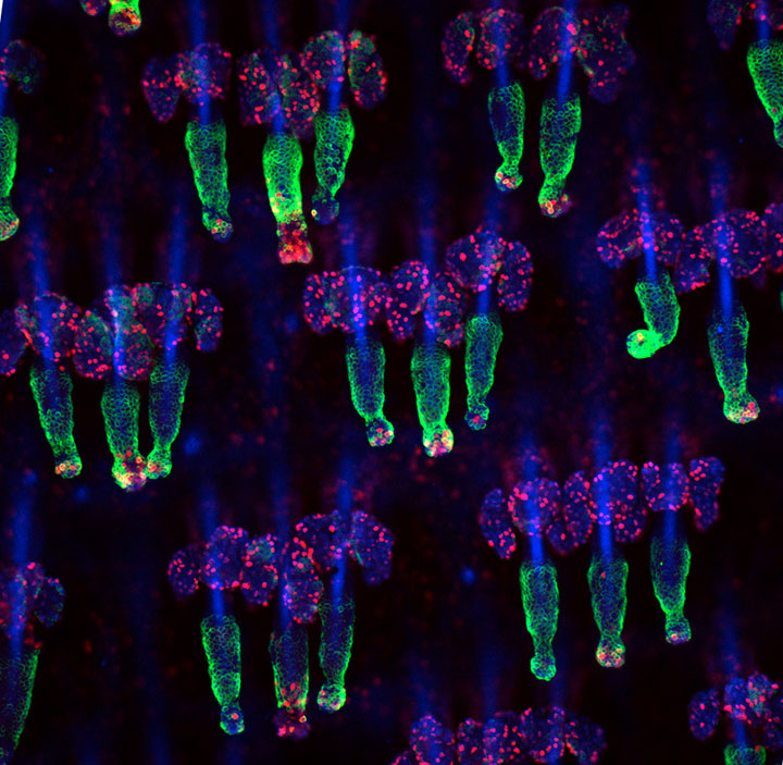 voici-les-gagnants-de-limage-microscopique-de-lannee-20137