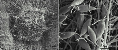 Pestalotiopsis microspora