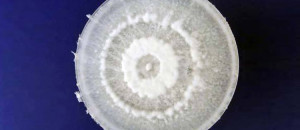 cette-decouverte-va-revolutionner-lecologie-ce-champignon-digere-totalement-le-plastique-une