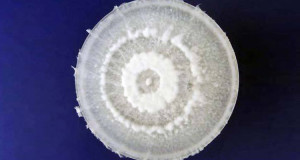 cette-decouverte-va-revolutionner-lecologie-ce-champignon-digere-totalement-le-plastique-une