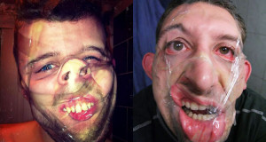 la-nouvelle-mode-du-selfie-completement-dejantee-la-defiguration-au-scotch-une