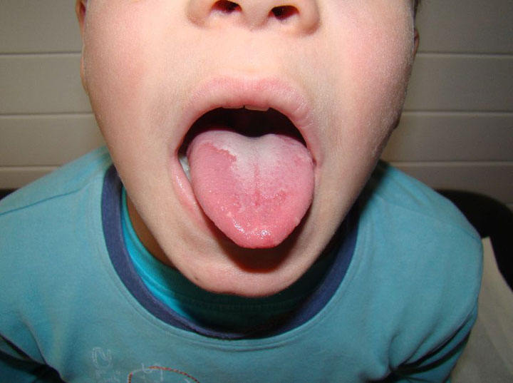 maladie-insolite-sante-humour10