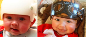 une-artiste-redonne-le-sourire-a-des-bebes-en-transformant-leur-casque-medical-en-veritable-oeuvre-dart-une