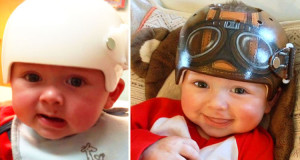une-artiste-redonne-le-sourire-a-des-bebes-en-transformant-leur-casque-medical-en-veritable-oeuvre-dart-une