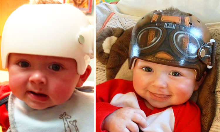 une-artiste-redonne-le-sourire-a-des-bebes-en-transformant-leur-casque-medical-en-veritable-oeuvre-dart-une
