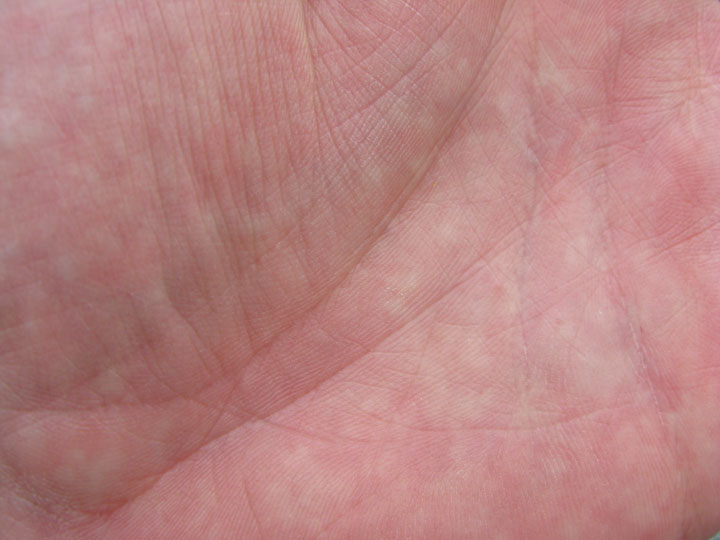 peau-humaine-fabrication-sperme1