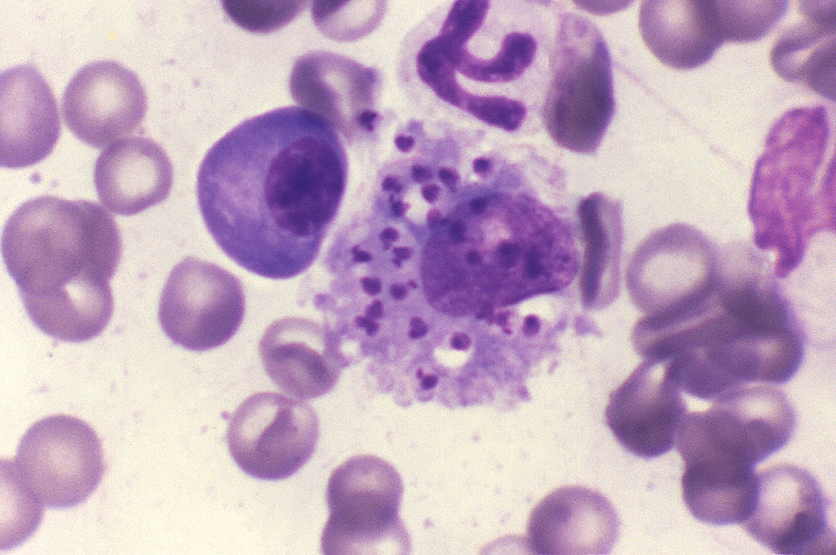 leishmania