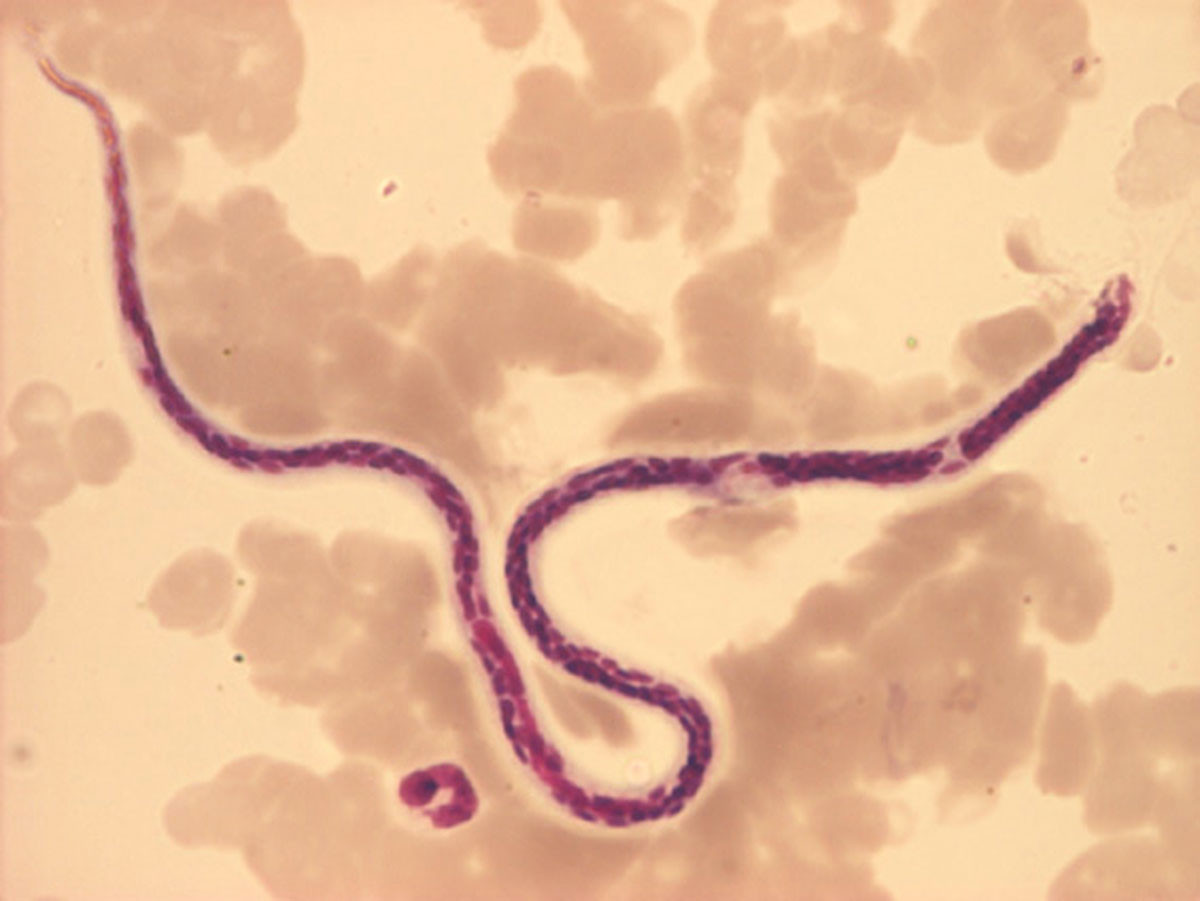 wuchereria-bancrofti