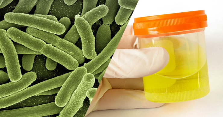 Une-urine-bacterie