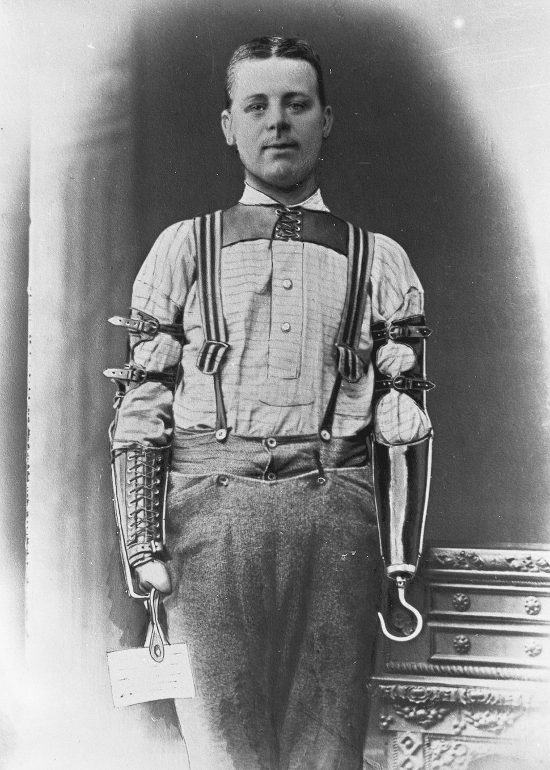 membre-prothese-creation-12