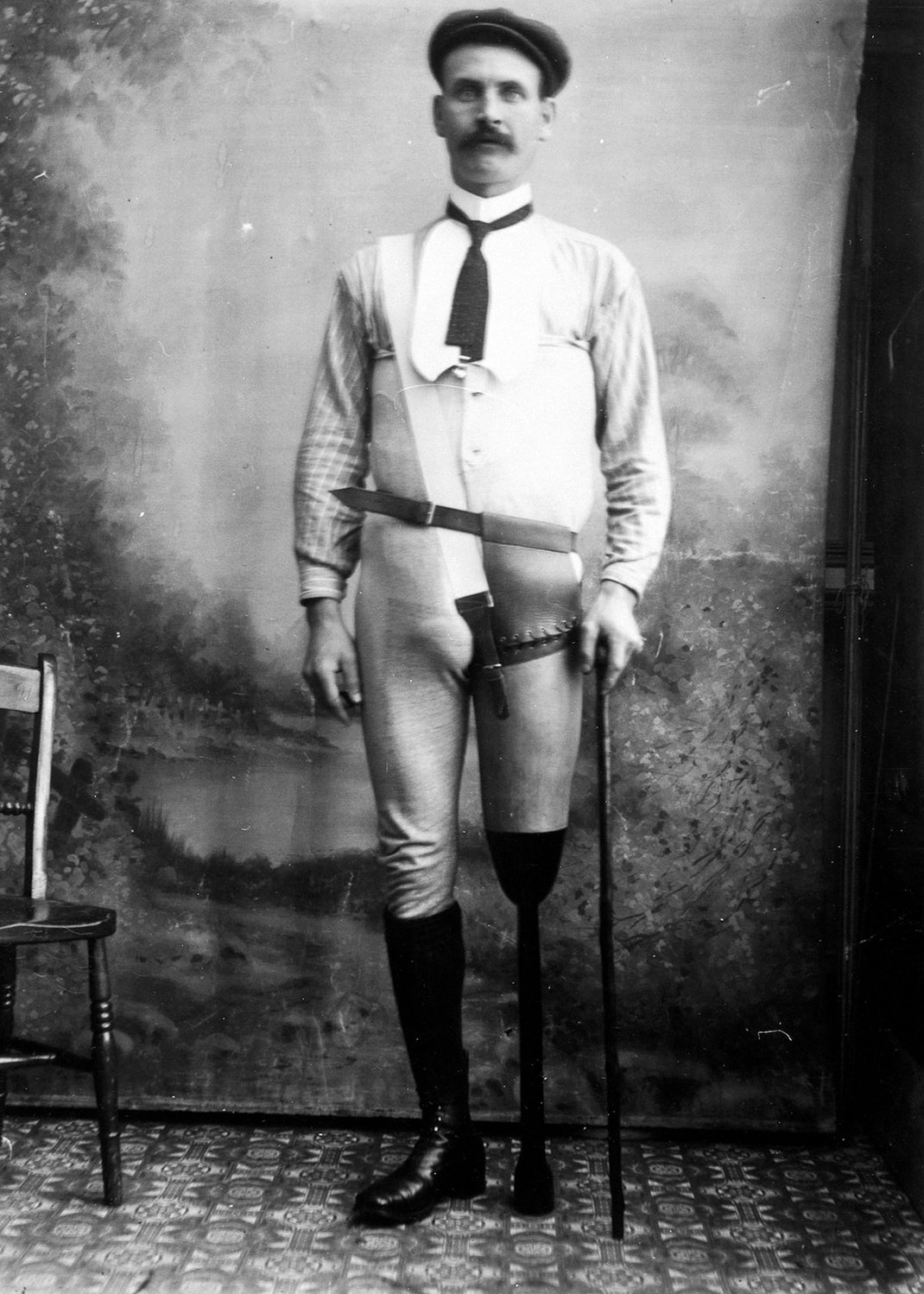 membre-prothese-creation-19