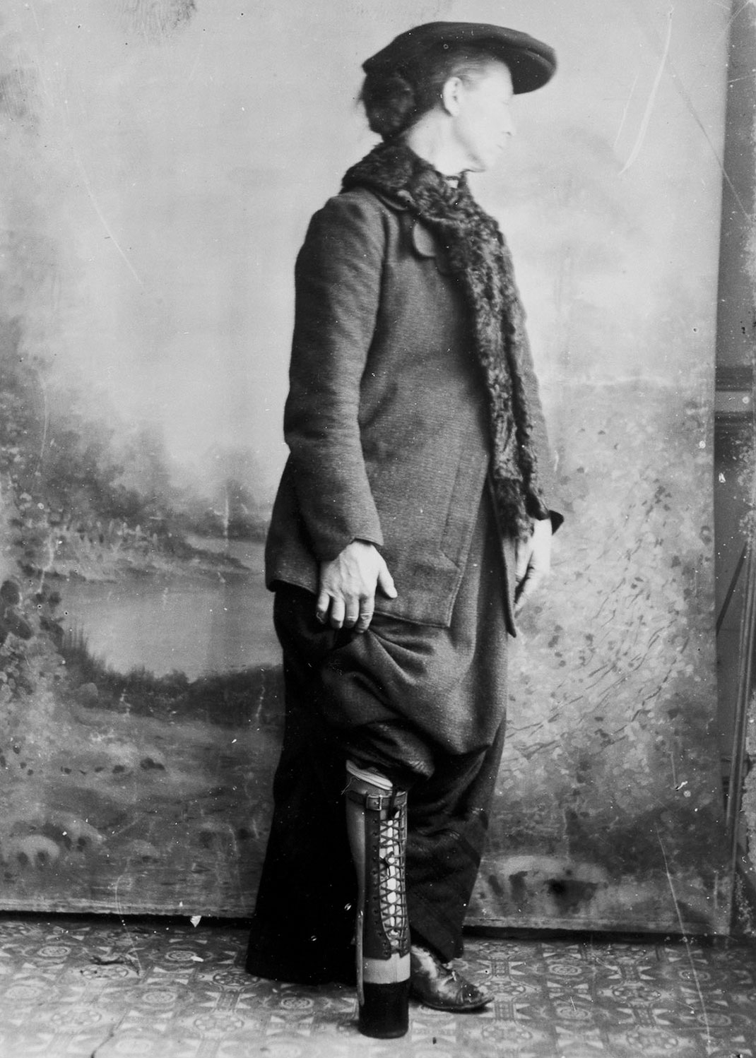 membre-prothese-creation-20