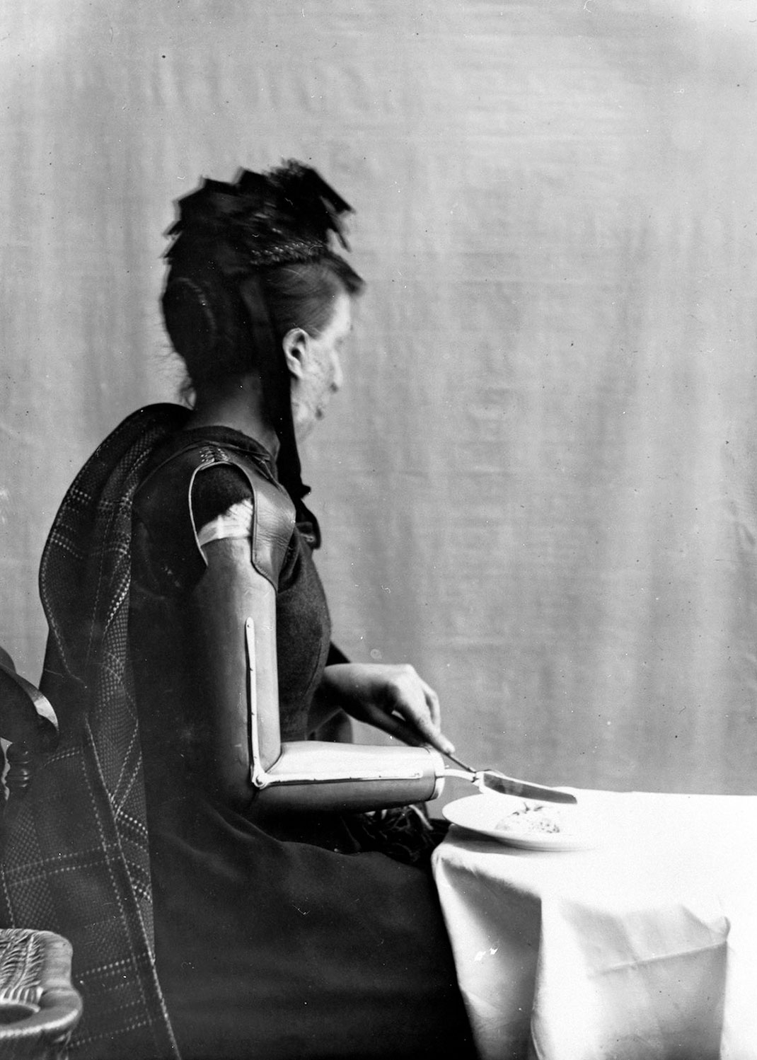 membre-prothese-creation-21