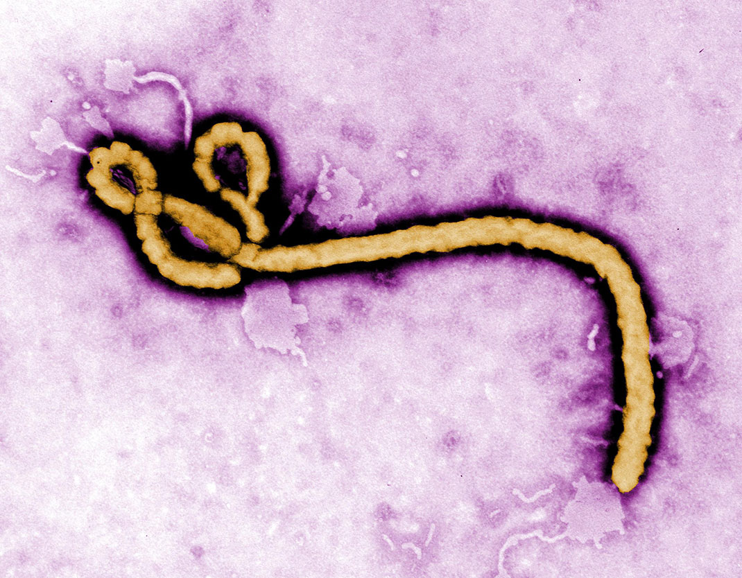 07-ebola-FrederickAMurphy