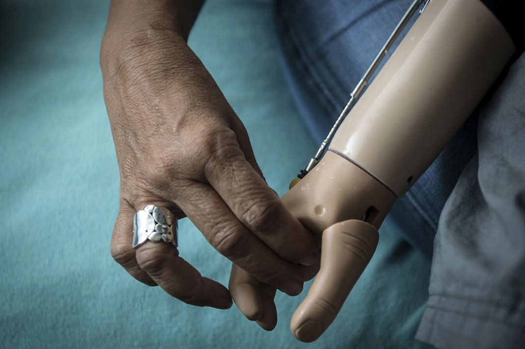 10-enfantalbinos-carloallegrireuters