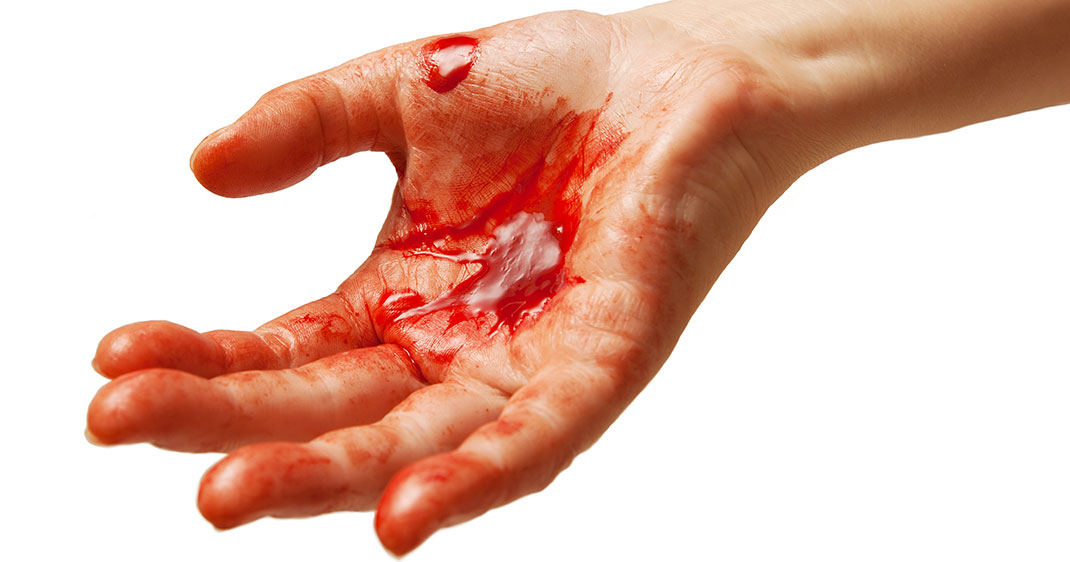 une-poudre-saignement