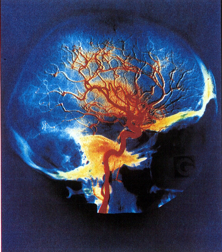 7071077223_122a8ab106_o