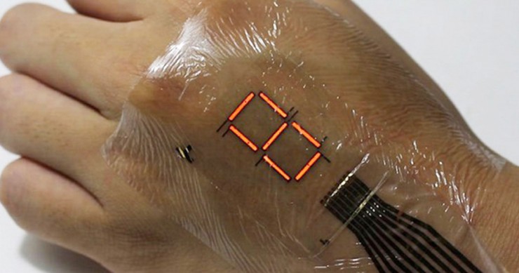 Une-patch-technologie