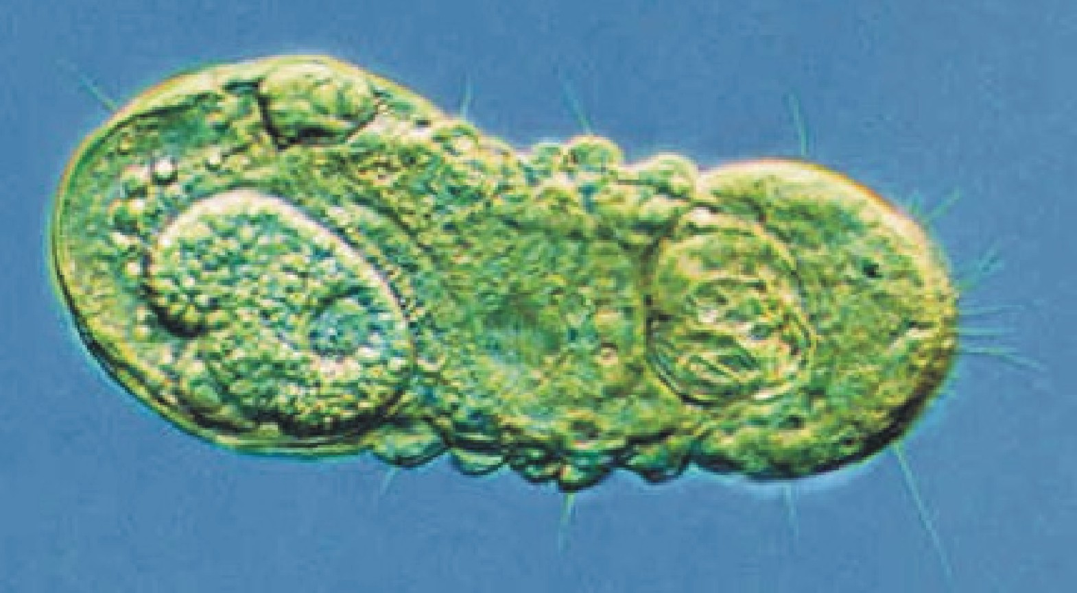 Micrognathozoa